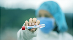 Francuska omogućila svojim građanima besplatno testiranje na koronavirus